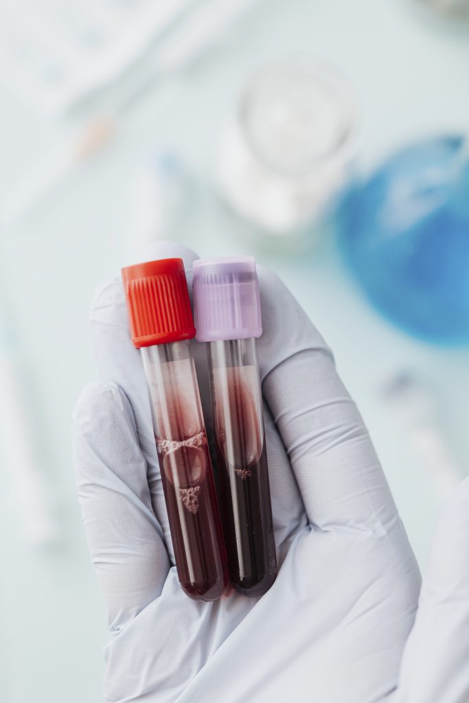 Two test tubes filled with blood samples, held by gloved hands.