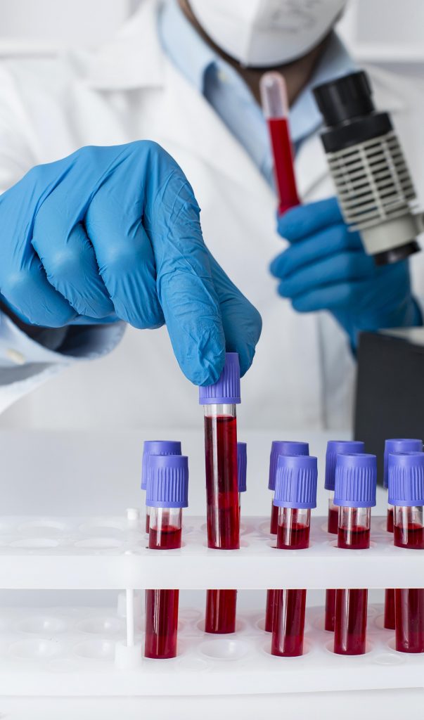 A lab technician working with blood samples, conducting tests for accurate results.