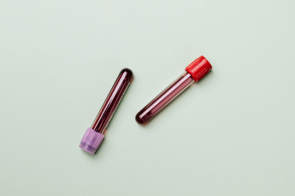 Two test tubes with blood samples, highlighting the importance of regular blood screening.
