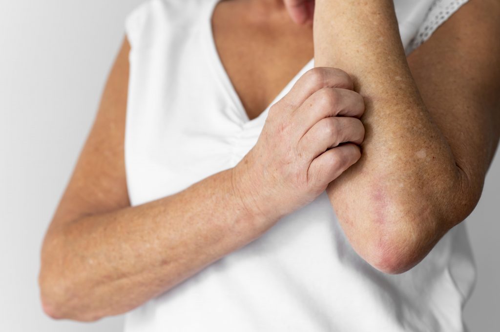 Elderly person in a white sleeveless top scratching arm, showing skin irritation, a sign of kidney failure-related itching.