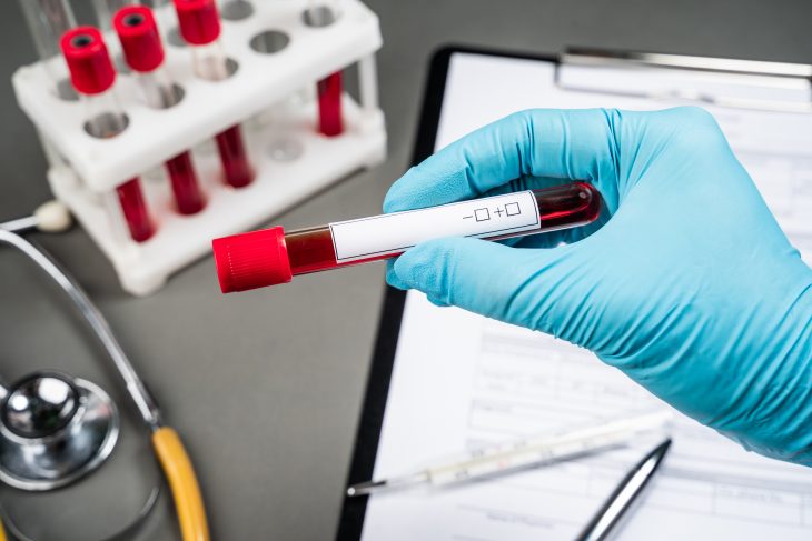 Image of Lab person collecting blood sample.