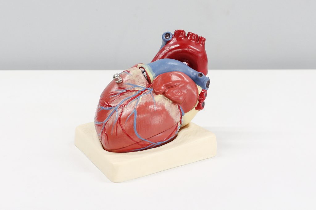 Heart model illustrating how the Mediterranean diet supports healthy cholesterol levels and lowers blood pressure risk.