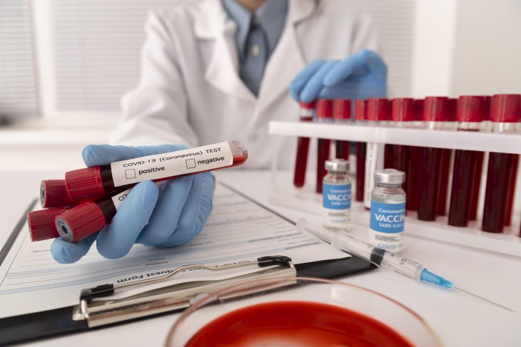 Image of Lab assistant holding blood samples for covid test.