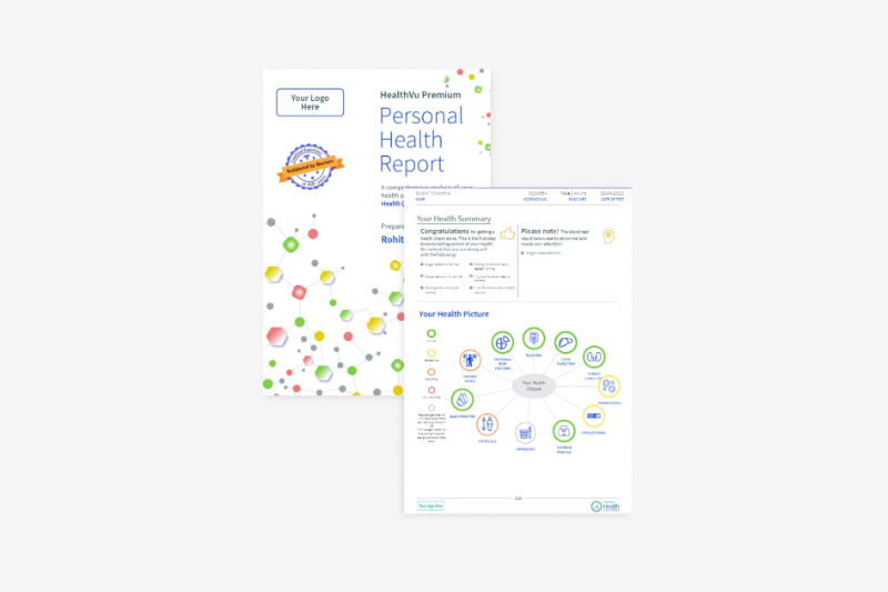 Health Vectors' Premium smart reports featuring advanced visualizations and personalized insights.