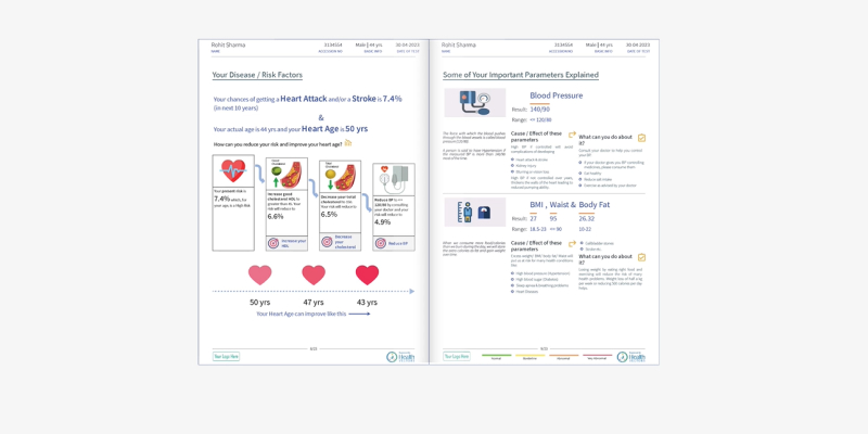 A smart report displaying risk factors and the calculated heart age based on the patient’s health data.