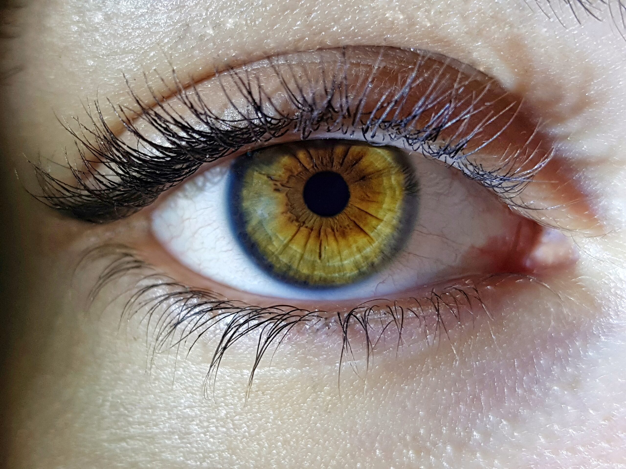 Close-up of a hazel eye with long lashes, illustrating the effects of vision impairment and retinopathy.